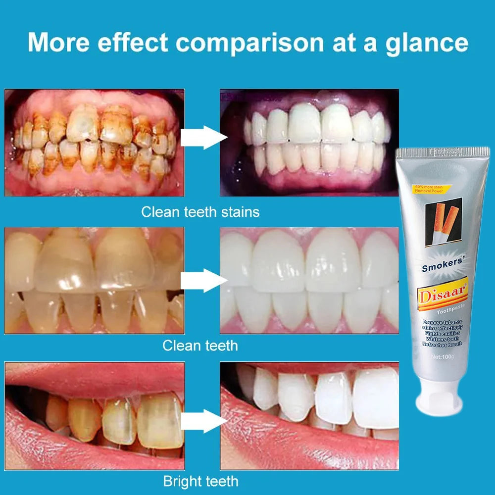 Teeth Whitening Repair Toothpaste