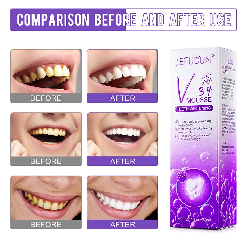 V34 Series Tooth Whitening Toothpaste