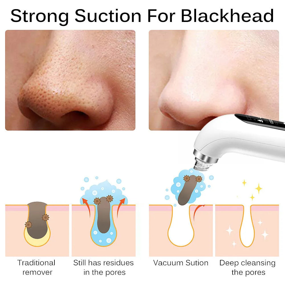 Electric Pimple Black Head Removal