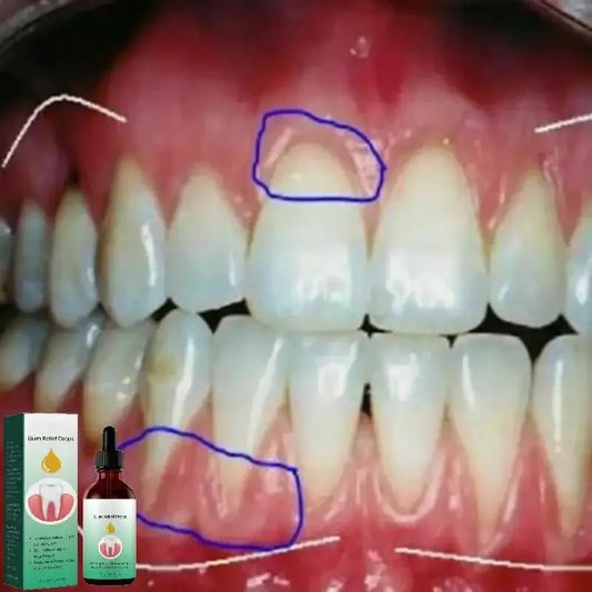 30ml Gingival Quickly Teeth Clean Repair