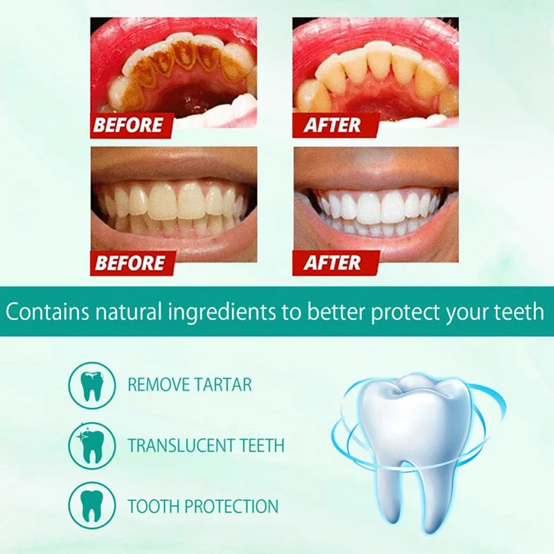 Teeth Whitening Mousse Toothpaste
