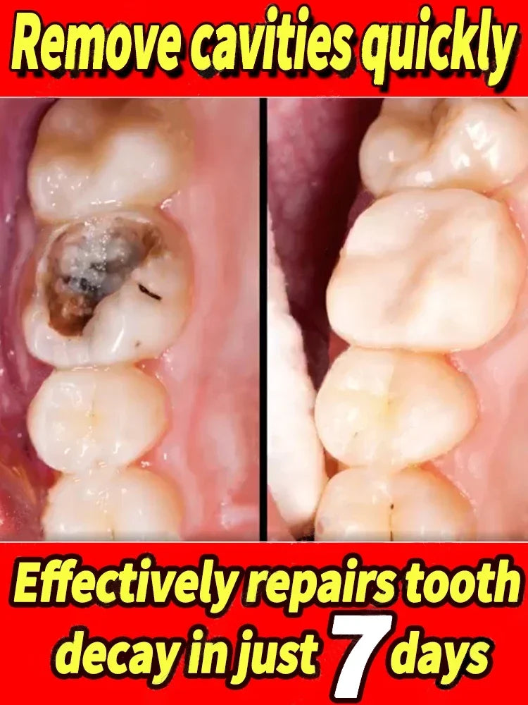 Teeth whitening anti-cavity Toothpaste