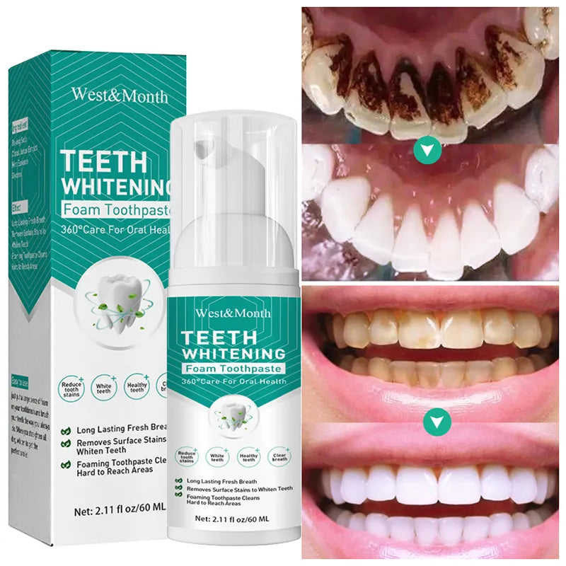 Teeth Whitening Mousse Toothpaste