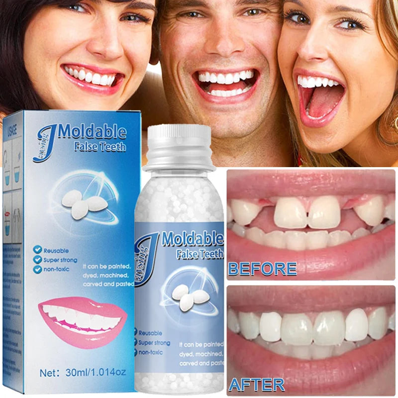 Moldable Temporary Tooth Repairing Whitening Kit