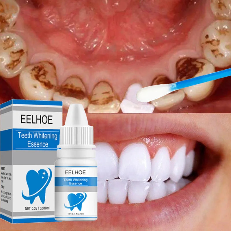 Teeth Whitening Essence Remove