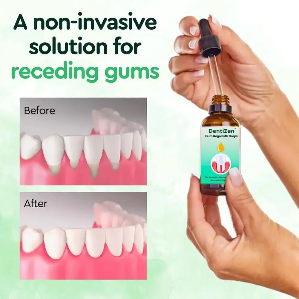 30ml Gingival Quickly Teeth Clean Repair