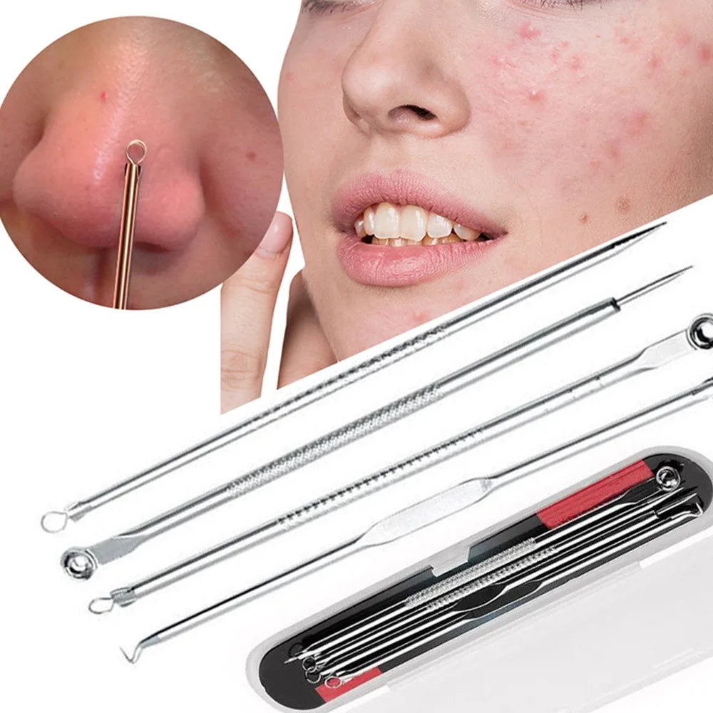 4pcs Blackhead Acne Remover Set