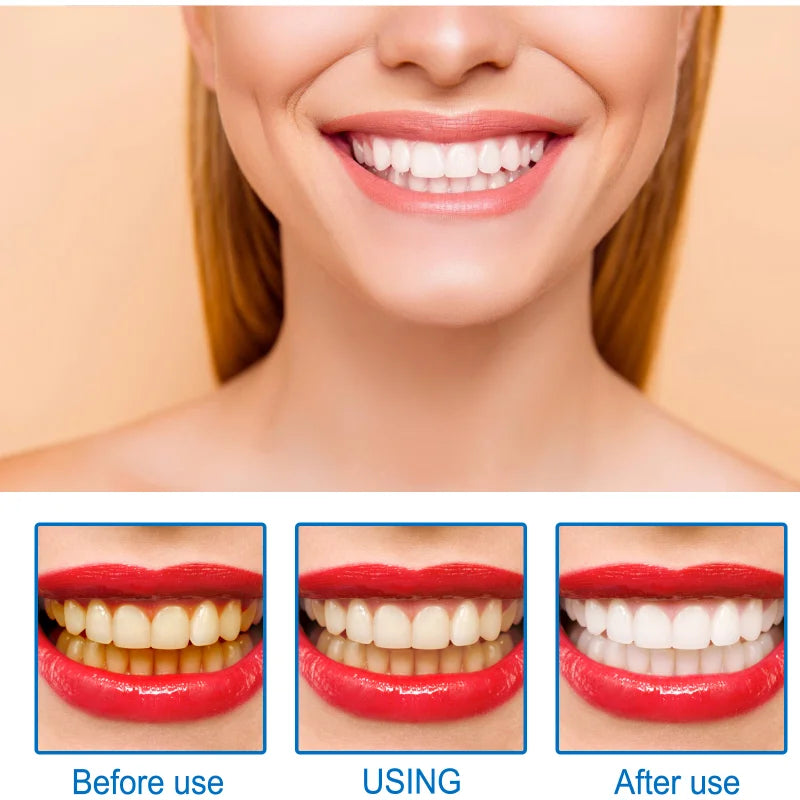 Teeth Whitening Essence Remove