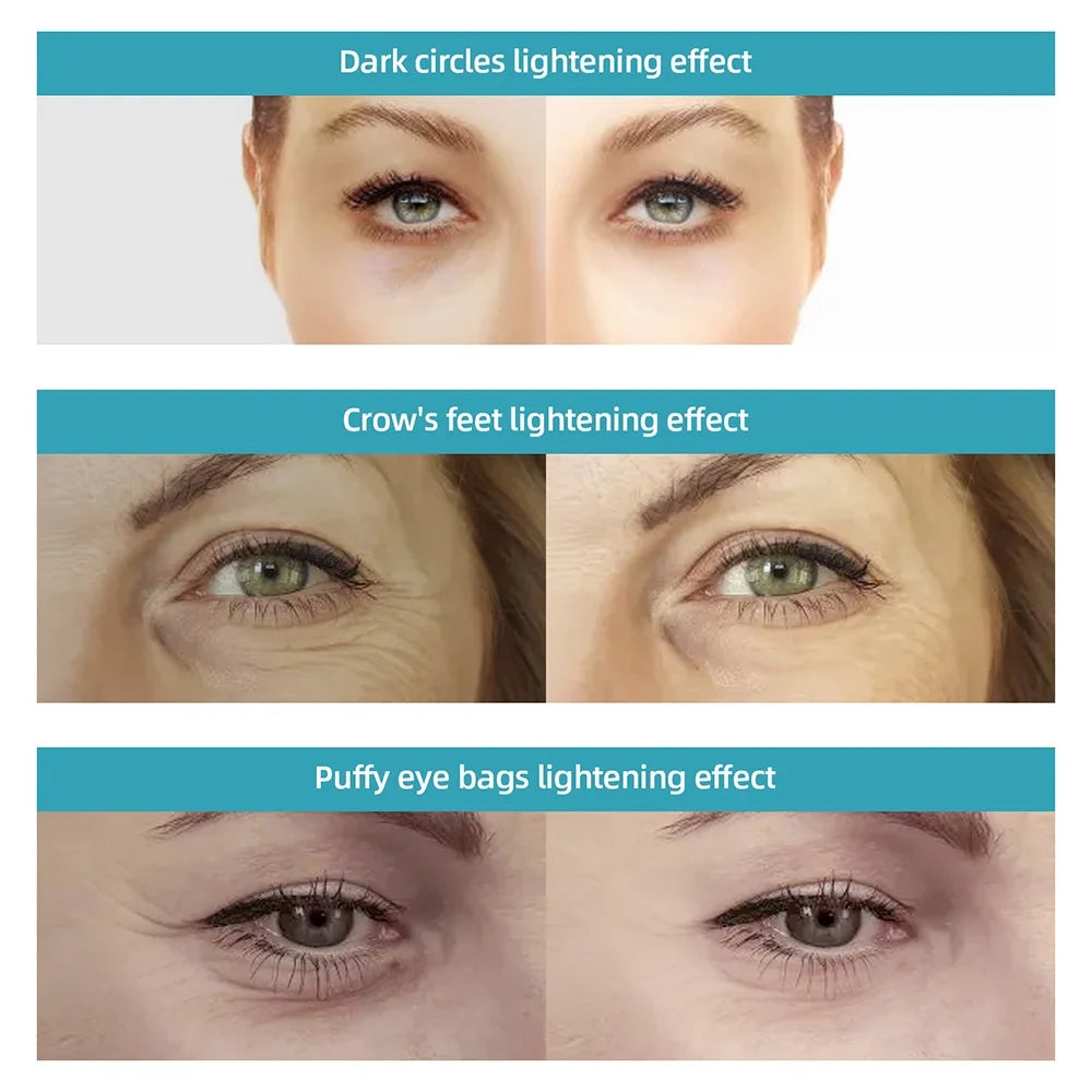 42℃ Hot Compress Eye Massager Pen