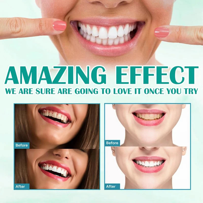 Teeth Whitening Mousse Toothpaste