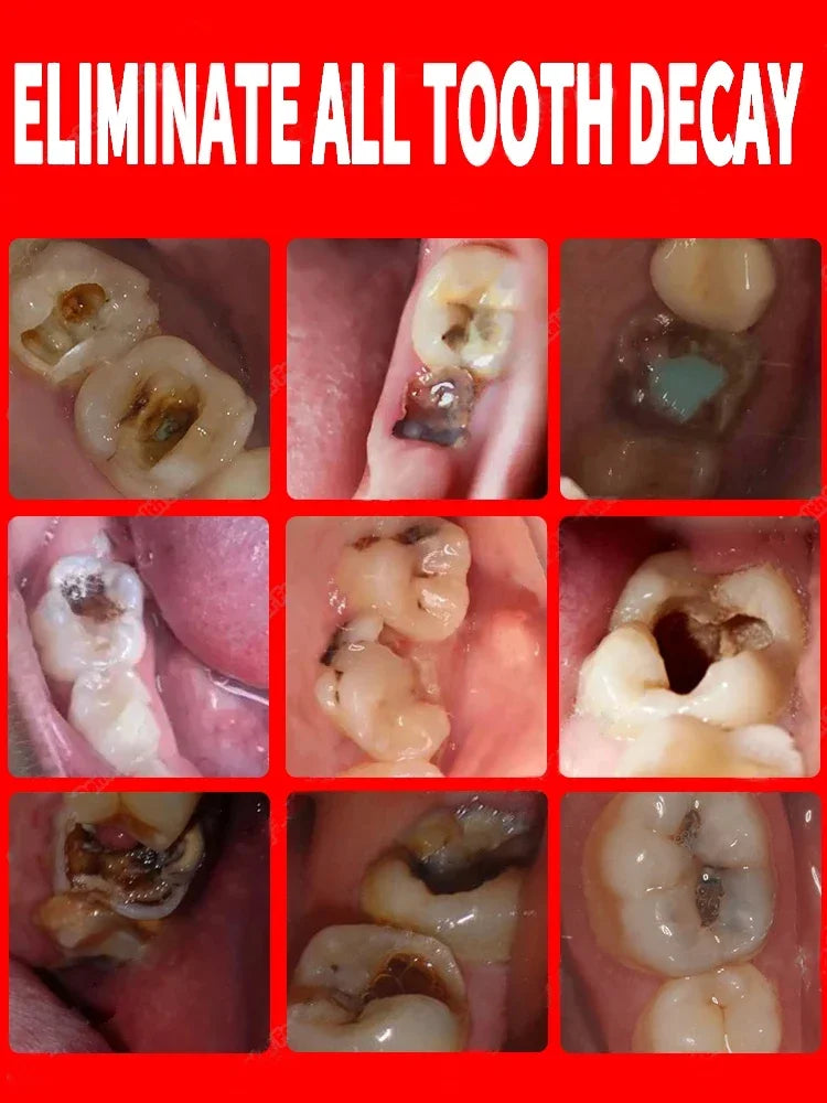 Teeth whitening anti-cavity Toothpaste