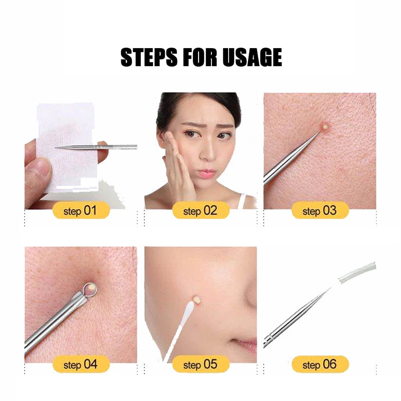 4pcs Blackhead Acne Remover Set