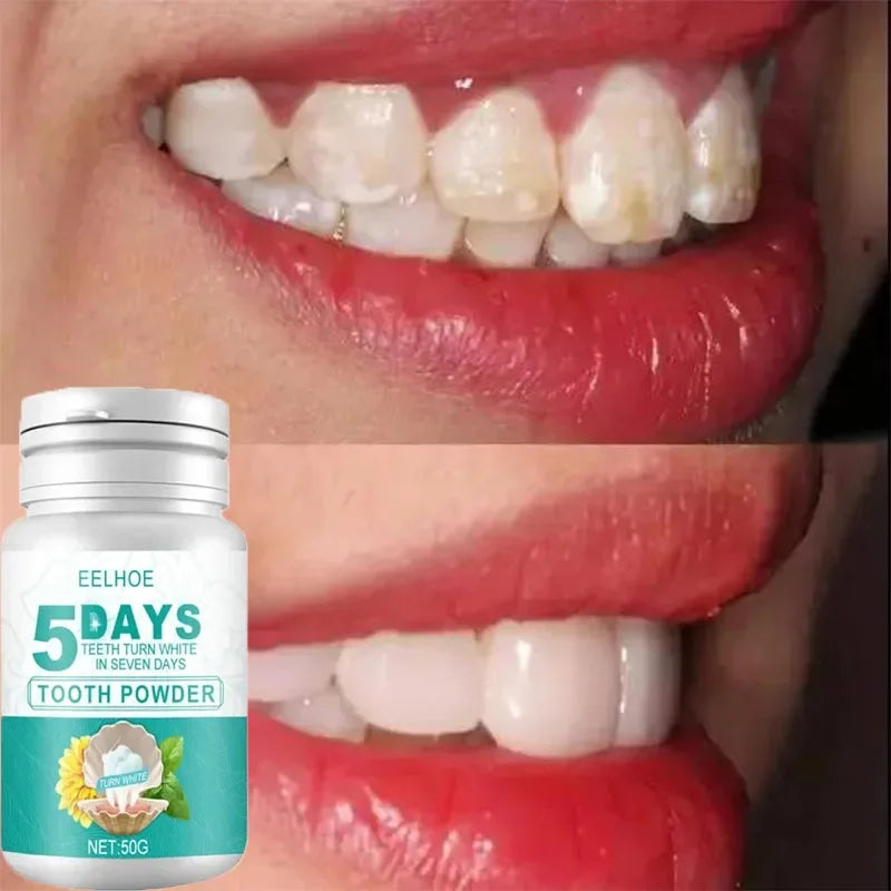 5 Days Teeth Whitening Toothpaste